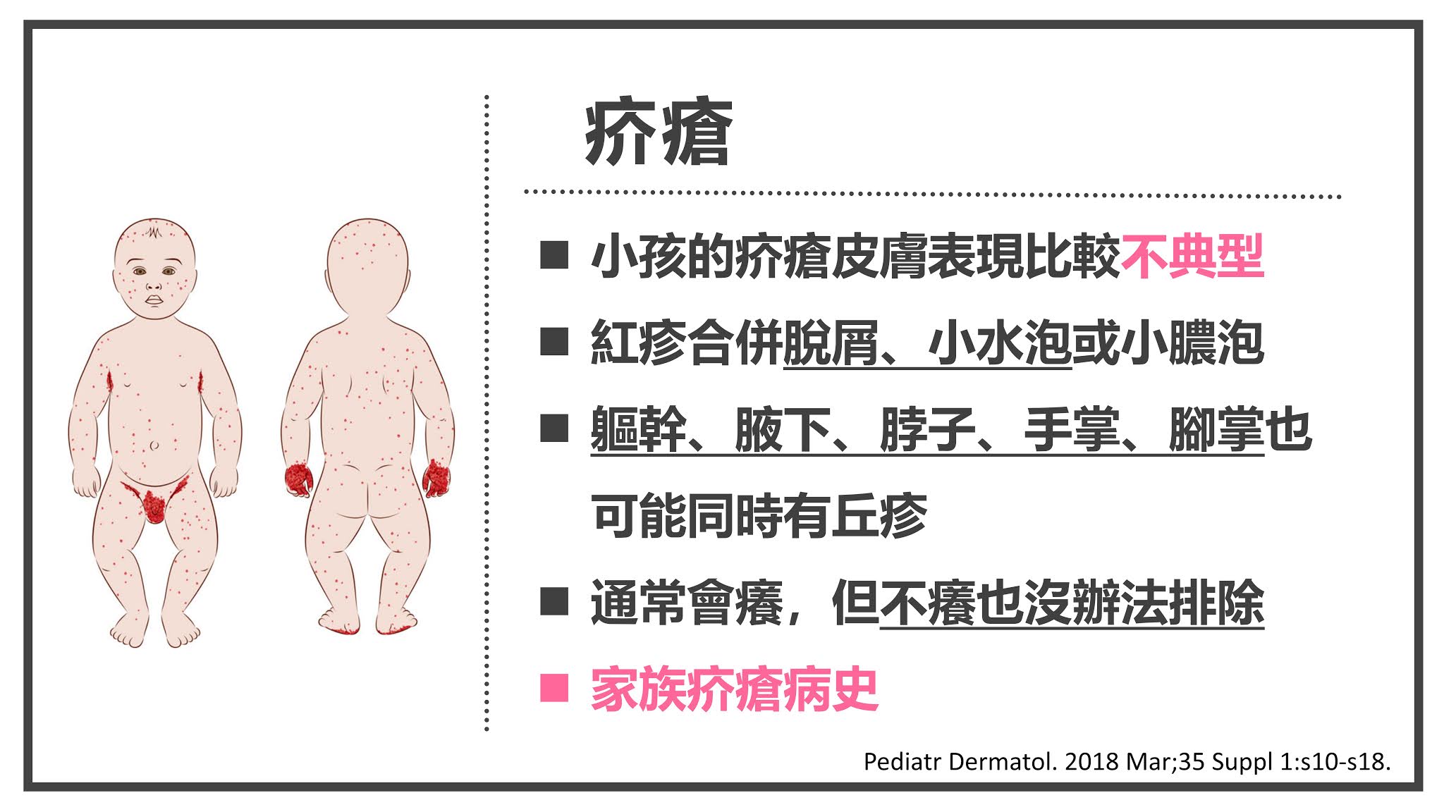婴儿尿布（挑选宝宝尿布的方法）-幼儿百科-魔术铺
