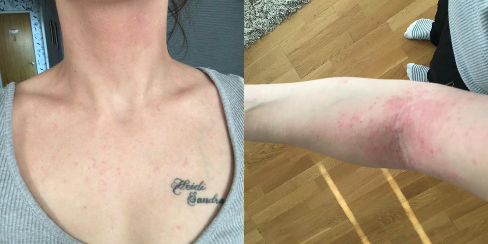 7 erstaunliche anabole steroide muskelaufbau -Hacks