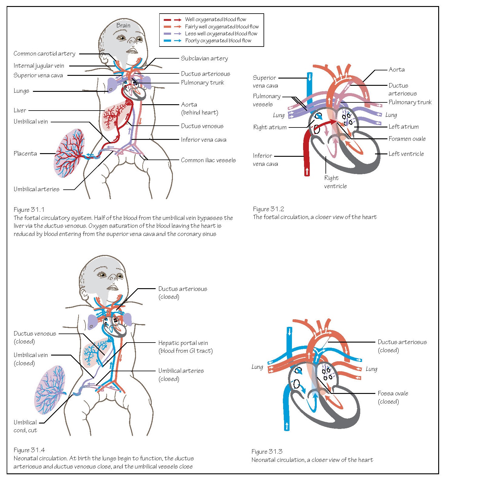 Circulation System Changes At Birth pediagenosis