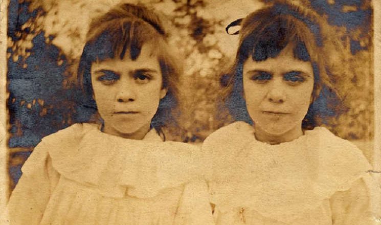 Misteri The Pollock Twins, Dua Gadis Kembar Hasil Reinkarnasi ...