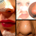 Step by Step On How to Remove Blackheads Overnight with Toothpaste and Salt