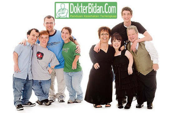 Achondroplasia Dwarfism Kerdil Bantet Ciri Penyebab Dan Cara Mengobatinya Achondroplasia Dwarfism Kerdil Bantet Ciri Penyebab Dan Cara Mengobatinya