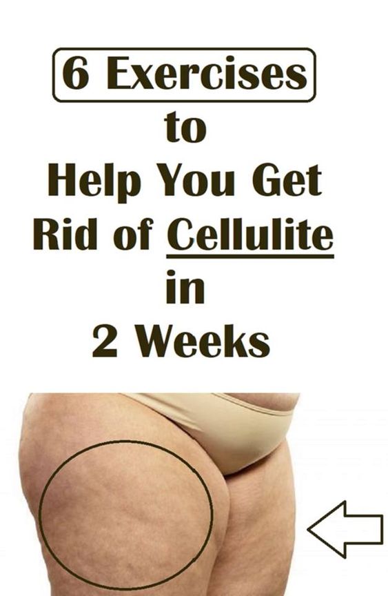Healthy Etips Six Exercises to Help You Get Rid of Cellulite in 2 Weeks