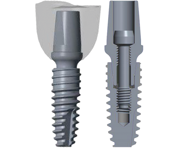 Best Dental Implants Manufacturer Pivot Implants Best Dental