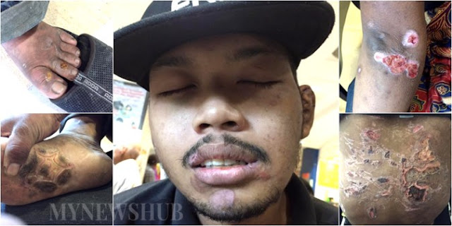 Bos Kurang Ajar, Tega Bakar Karyawan Hanya Karena Tak Capai Target Penjualan! Bos Kurang Ajar, Tega Bakar Karyawan Hanya Karena Tak Capai Target Penjualan!