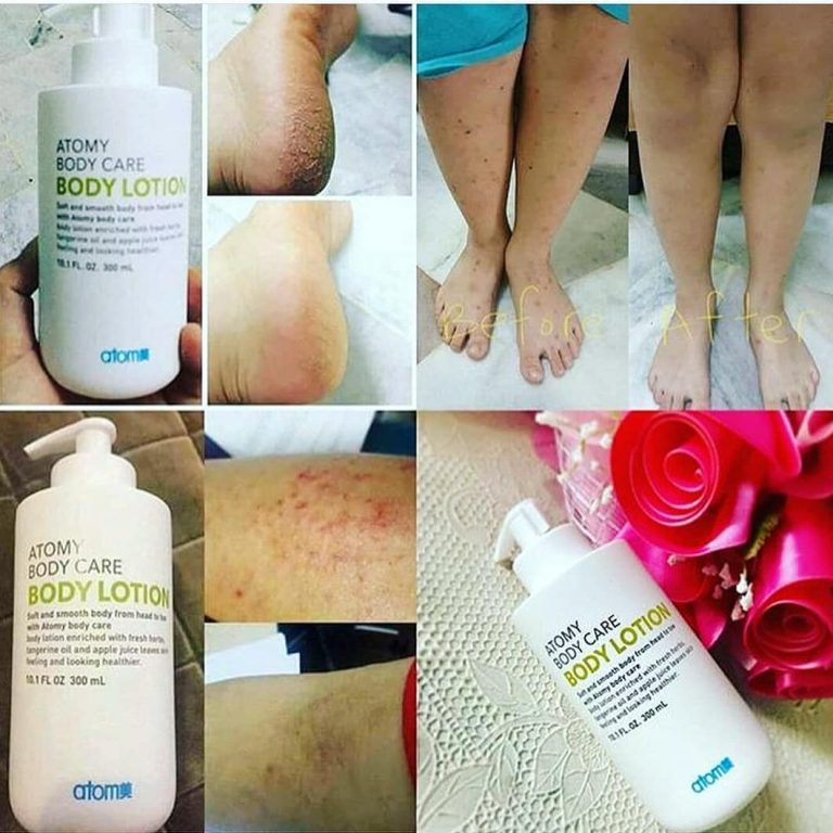 атоми лосьон. лосьон для тела атоми. лосьон от атоми состав. Atomy lotion hd. атоми корейская косметика.