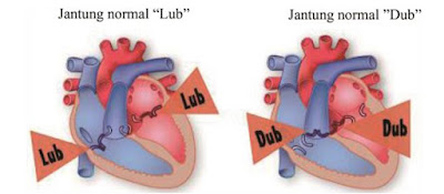 Bunyi jantung secara tradisional digambarkan sebagai lup-dup dan dapat di dengar melalui stetoskop. “lup” mengacu pada saat katup AV menutup dan “dup” mengacu pada saat katup semilunar menutup (gambar 6). Bunyi ketiga atau keempat adalah bunyi jantung yang abnormal yang disebabkan fibrasi yang terjadi pada dinding jantung saat darah mengalir dengan cepat ke dalam ventrikel, dan dapat di dengar jika bunyi jantung diperkuat dengan mikrofon