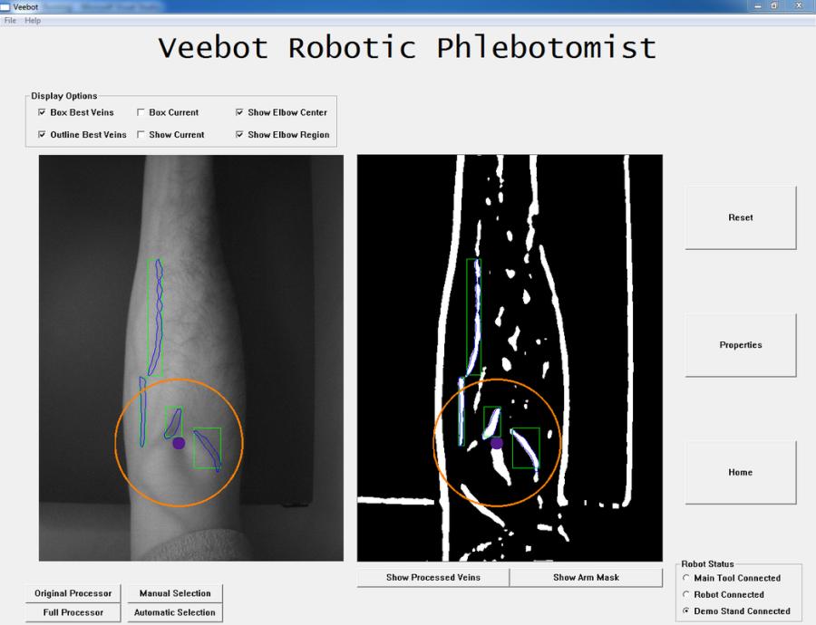 Veebot Blood Drawing Robot Mechatronics Engineering