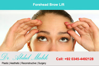 Forhead Brow Lift Surgery, brow lift surgery, and forehead surgery with optimal results by the best plastic surgeon in Lahore