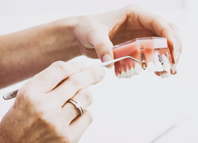 how to find free low-cost dental care frugal dentistry