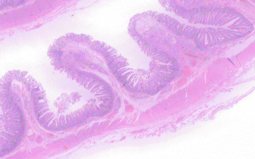 GASTROINTESTINAL AND LIVER HISTOLOGY PATHOLOGY ATLAS: DUODENUM NORMAL