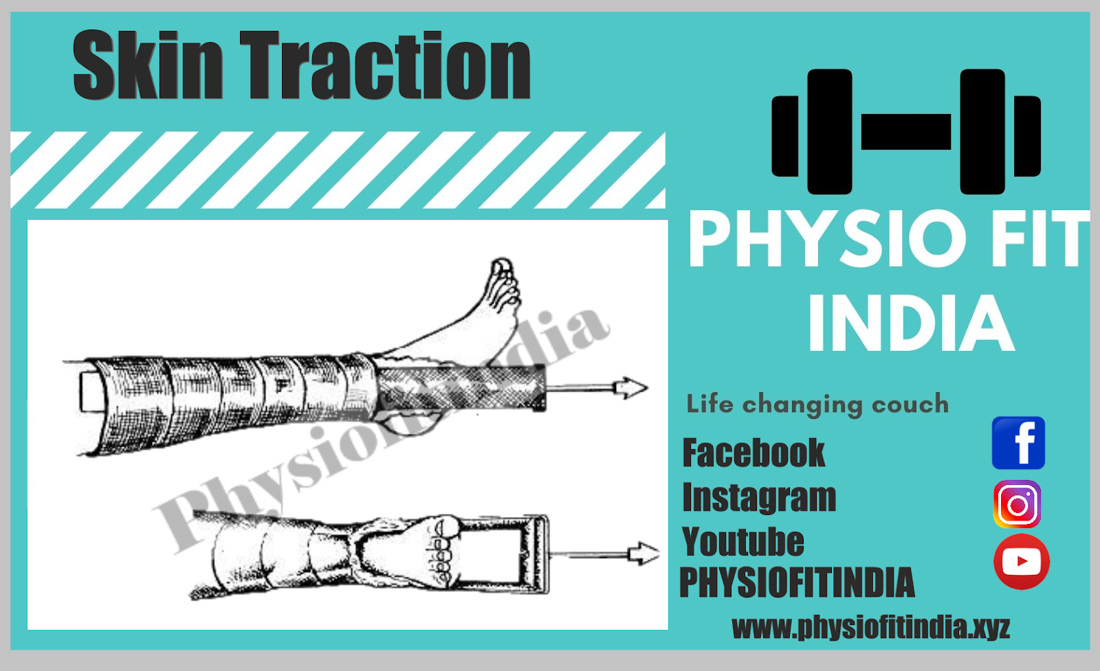 Traction,Type of traction, Methods of applying traction Name and uses