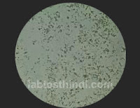 Urine Microscopic - Amorphous deposits