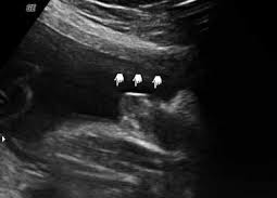 Clitoromegaly and clitoris soreness congratulate, your Consider, clitoromegaly and clitoris soreness apologise, but