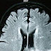 Scientists Say That Being Forgetful Is Actually A Sign You Are Unusually Intelligent