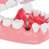 Địa chỉ trồng răng implant ở đâu tốt tại tphcm