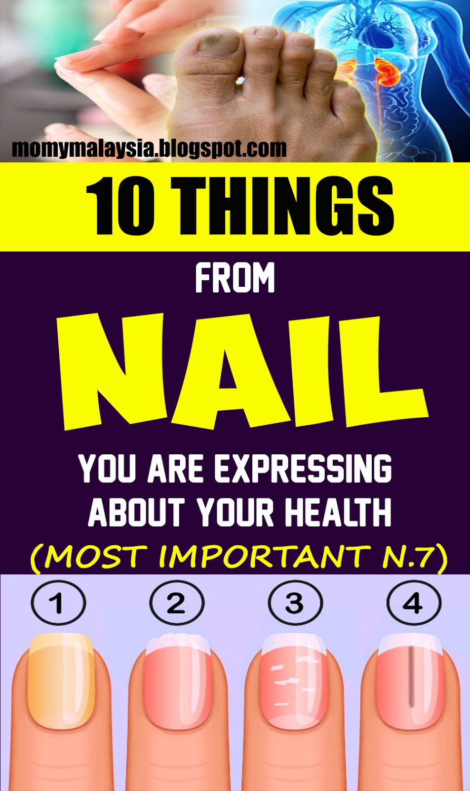 Here Are 10 Things Your Nails Can Reveal About Your Health!!!