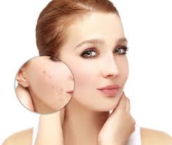 خلطات ووصفات تجميل البشره 2018 خلطات ووصفات تجميل البشره 2018