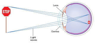  Refraction of the light in eye