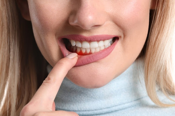 Signs of periodontitis, methods of treatment and prevention Signs of periodontitis