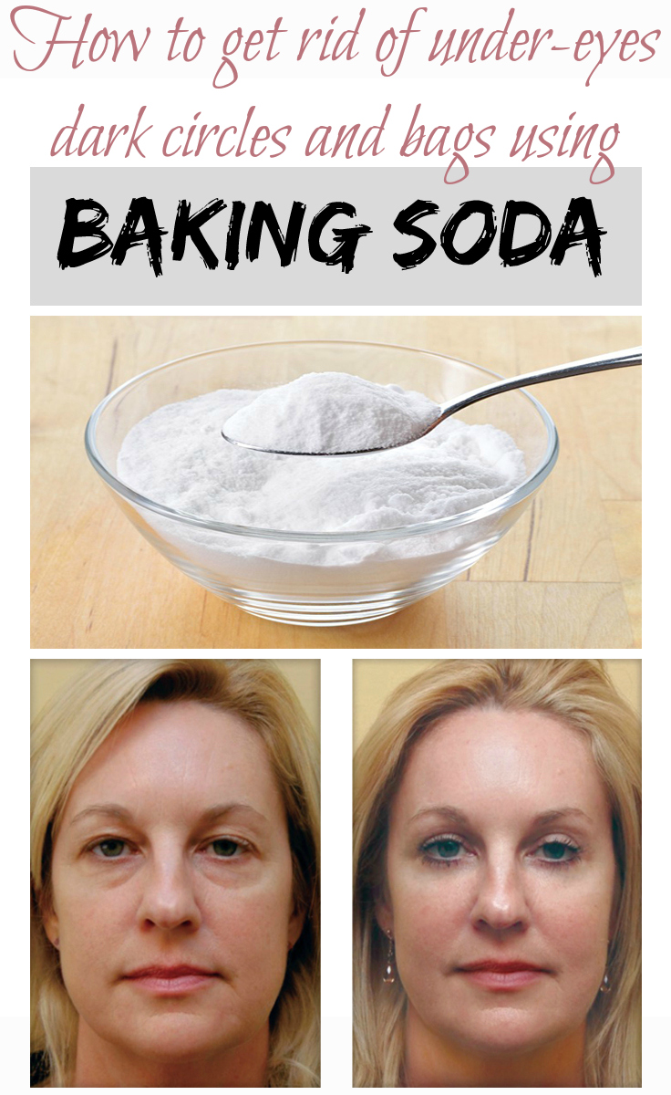 Best Natural Way To Get Rid Of Bags Under Eyes Best Natural Way To Get Rid Of Bags Under Eyes