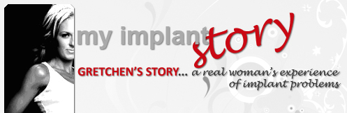 My Implant Story