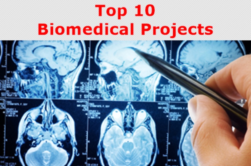 Top 10 Biomedical Projects With Source Code Top 10 Final Year
