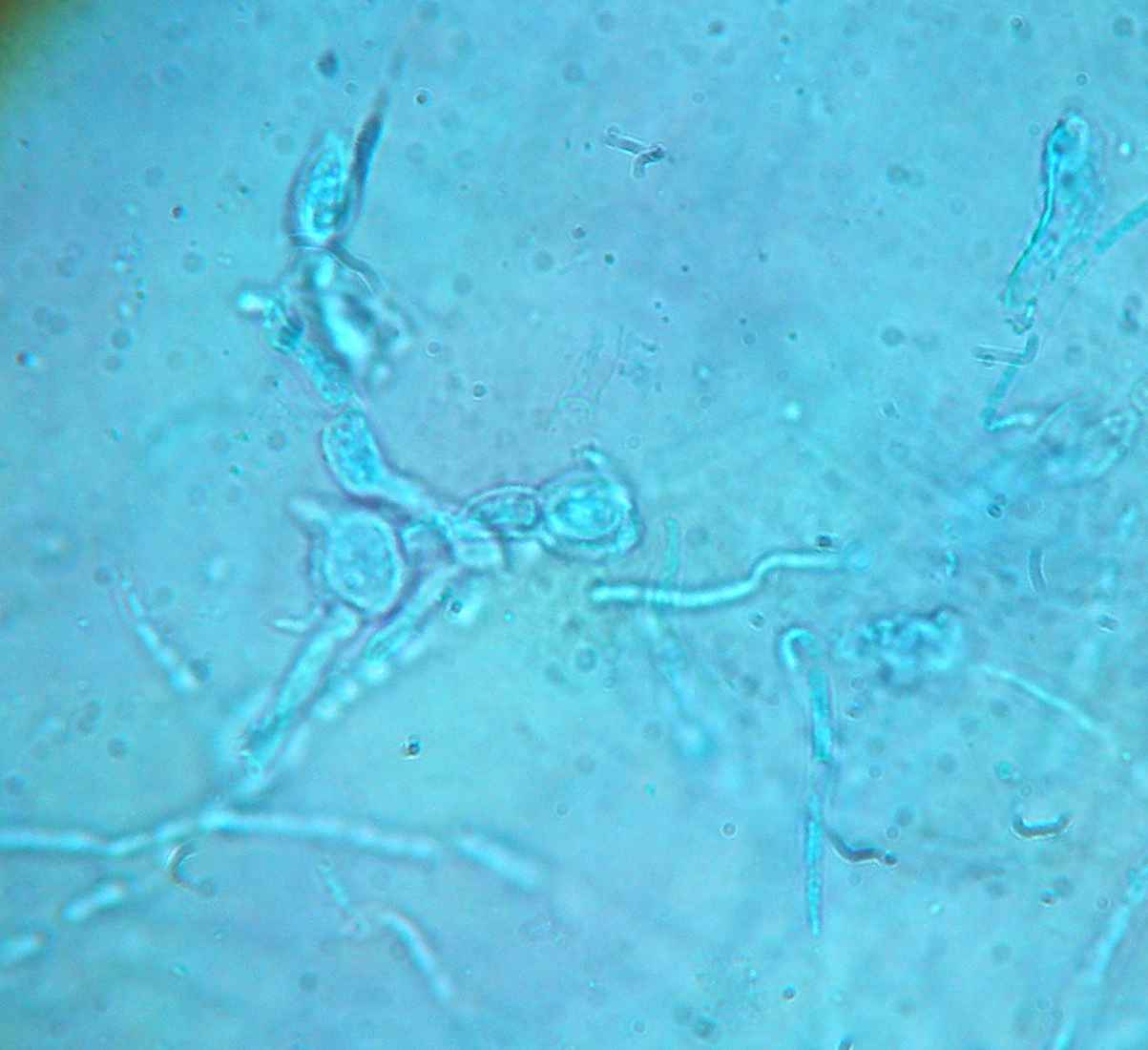 Epidermophyton floccosum