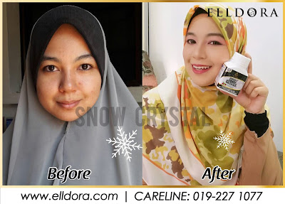 tips kulit sihat, kulit cantik, suplemen untuk kulit, kulit bebeas jerawat, petua mengurangkan jerawat, kulit kering, tona tak sekata, kulit kusam, jeragat, melembabkan kulit, petua kesihatan kulit, fungsi kulit, nak cantik, nak sihat, mua kodiang, mua murah, make up cantik, pengantin cantik, pengantin snow crystal, make up tahan lama, ctdk, siti nurhaliza, baby siti nurhaliza, siti aafiyah kahlid, tips kulit sihat, kulit cantik, suplemen untuk kulit, kulit bebeas jerawat, petua mengurangkan jerawat, kulit kering, tona tak sekata, kulit kusam, jeragat, melembabkan kulit, petua kesihatan kulit, fungsi kulit, nak cantik, nak sihat, mua kodiang, mua murah, make up cantik, pengantin cantik, pengantin snow crystal, make up tahan lama, ctdk, siti nurhaliza, baby siti nurhaliza, siti aafiyah kahlid,