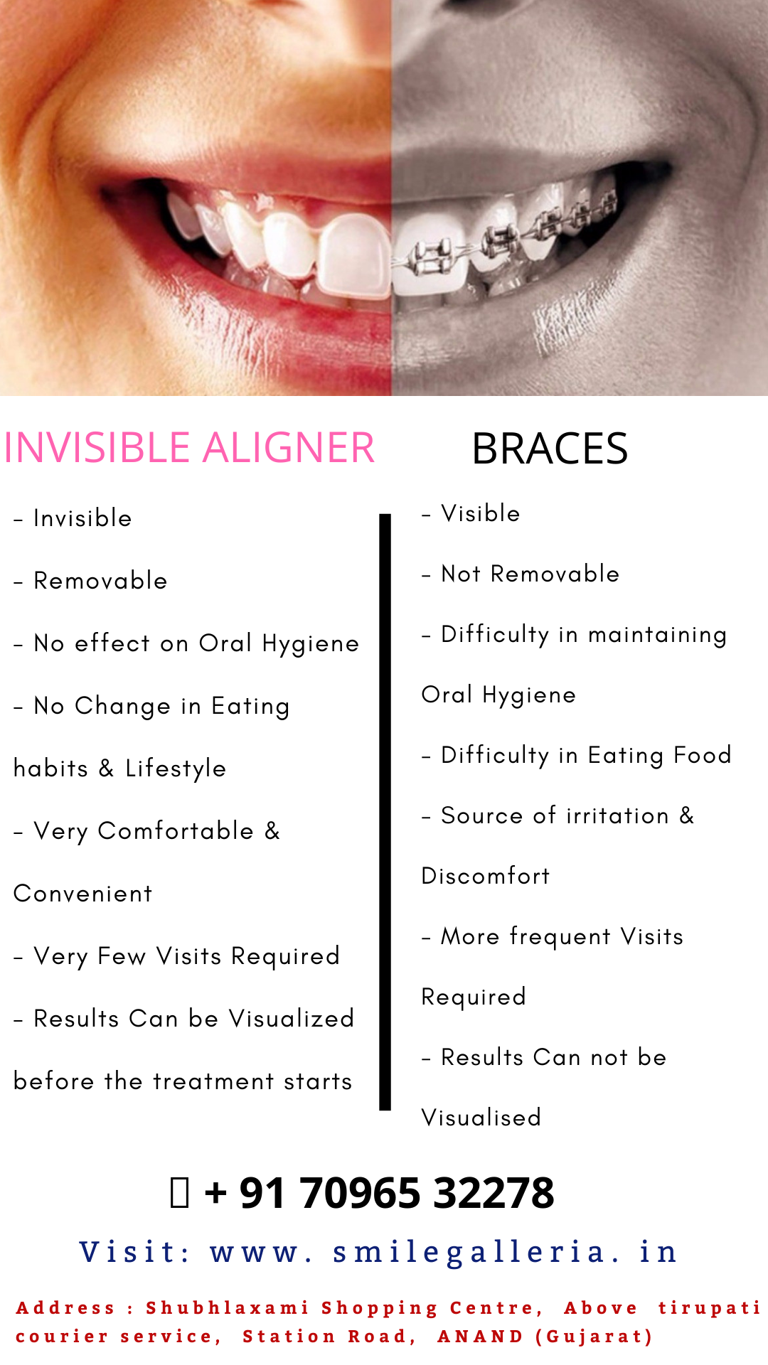best invisible aligners reddit best invisible aligners reddit