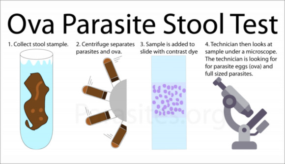Ova and Parasite Test