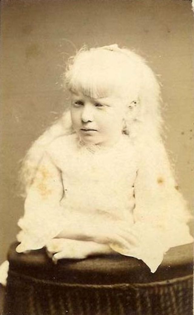 Родившиеся в 1800 году. Цирк уродов Викторианская эпоха. Альбиносы в 19 веке. Альбиносы в викторианскую эпоху.