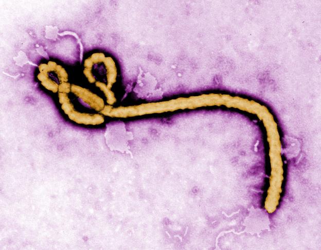 Confirmado primeiro caso de Ebola transmitido sexualmente