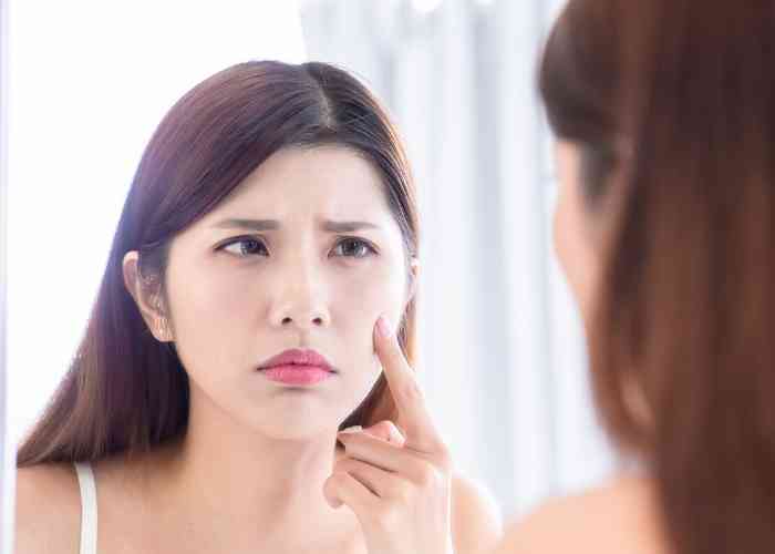 How To Cover Up Red Acne Diy Green Corrector Paperblog Green Corrector Diy Acne Green Color Corrector