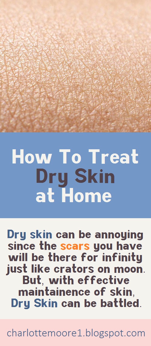 How To Treat Dry Skin at Home Charlotte Moore