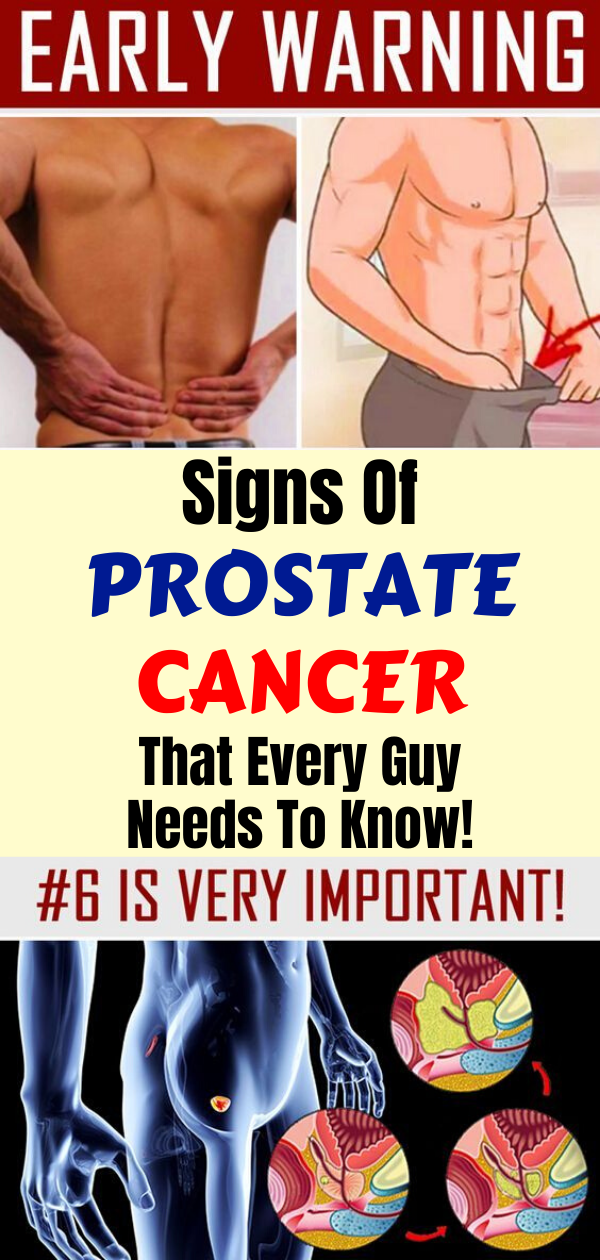 12 Early Warning Signs Of Prostate Cancer That Every Guy Needs To Know