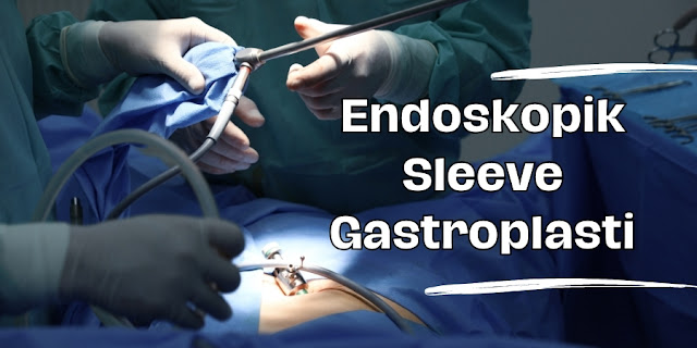 Endoskopik Sleeve Gastroplasti