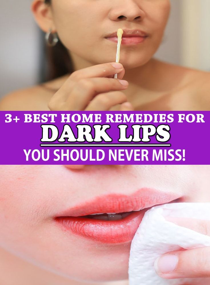 How to Lighten Dark Upper Lips