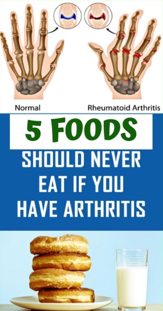 5 Foods You Should Never Eat If You Have Arthritis wellness magazine