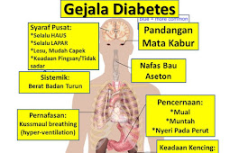 Jual Obat Herbal Diabetes Ampuh Di Toba Samosir | WA : 0822-3442-9202