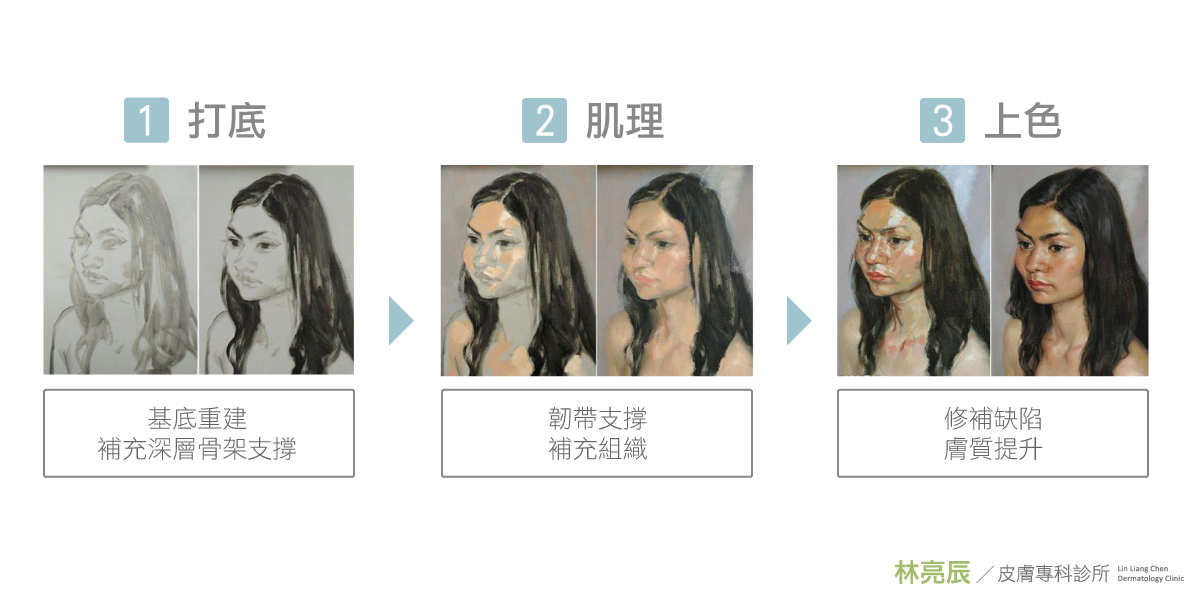 3D聚左旋乳酸sculptra舒顏萃液態拉皮童顏針打多少CC費用多少錢價格新竹林亮辰醫師林亮辰皮膚專科診所複利效應4