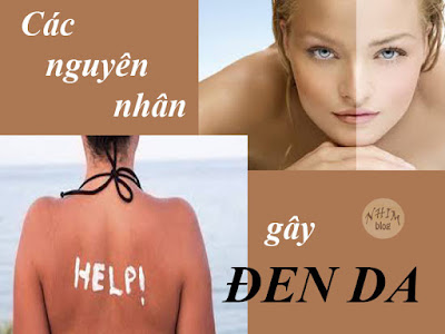 Các nguyên nhân gây đen da Các nguyên nhân gây đen da