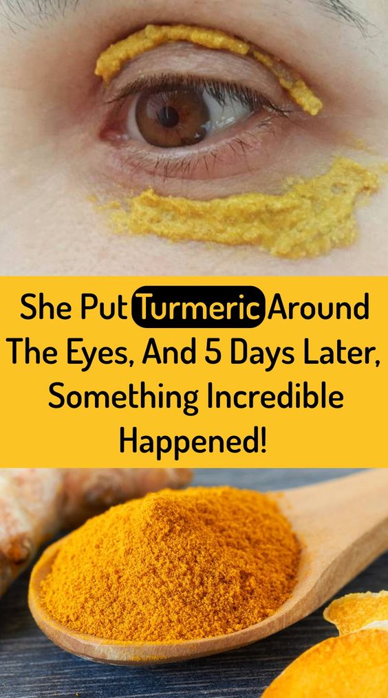 She Started Applying Turmeric Around Her Eyes. 10 Minutes Later. UNBELIEVABLE! Wellness Days