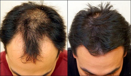 Boost Your Hair Growth With Natural Remedies Biafra Today