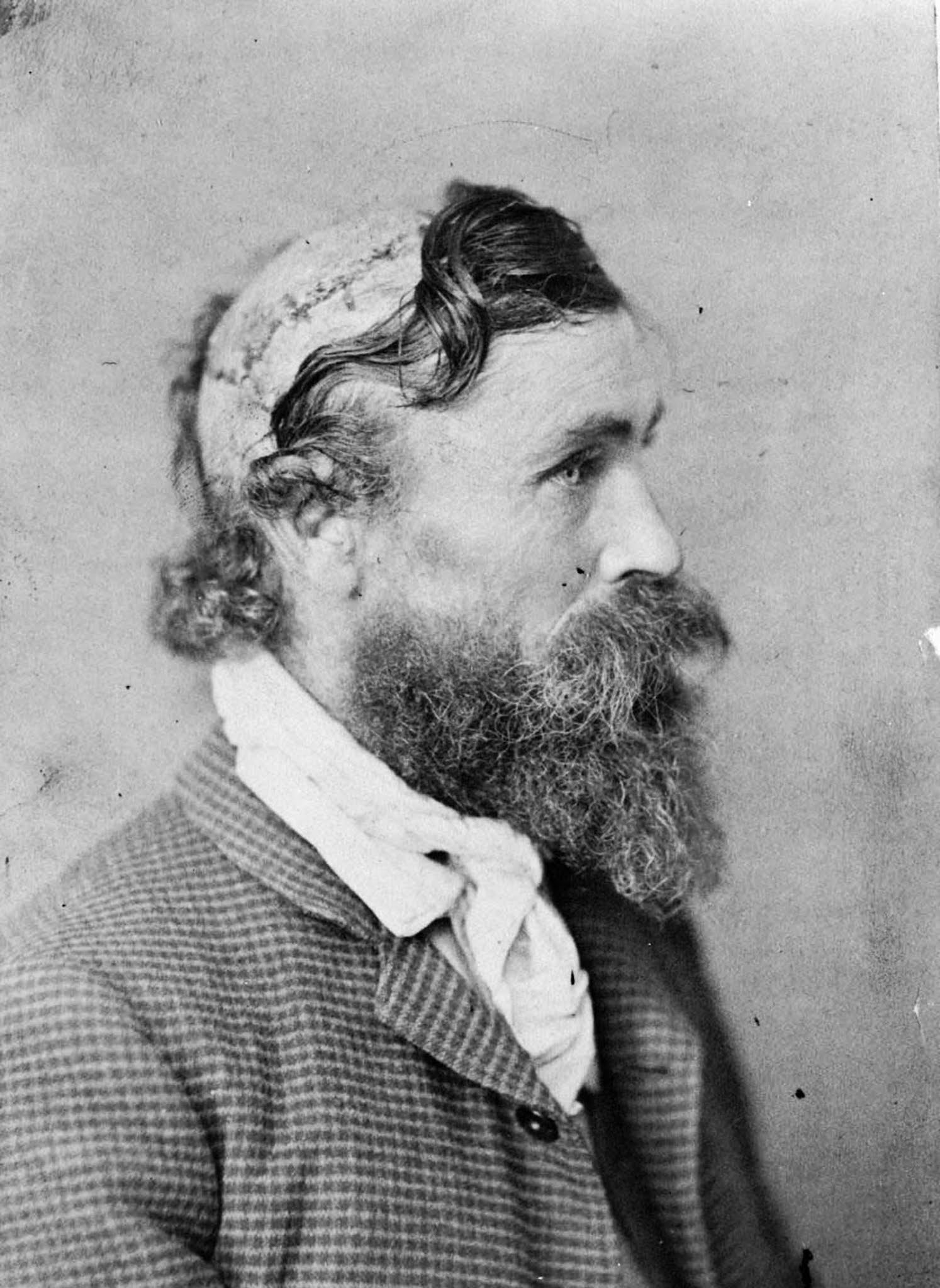 robert mcgee scalped