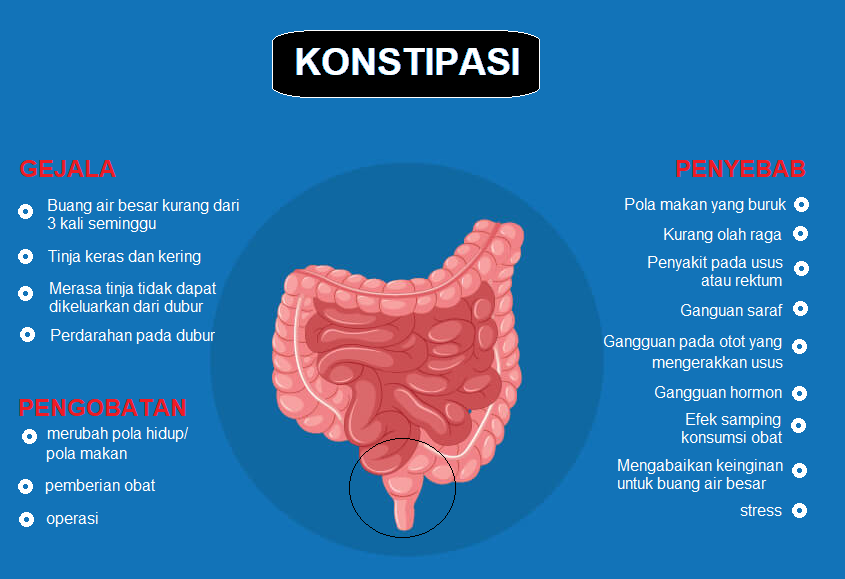 Gambar Konstipasi