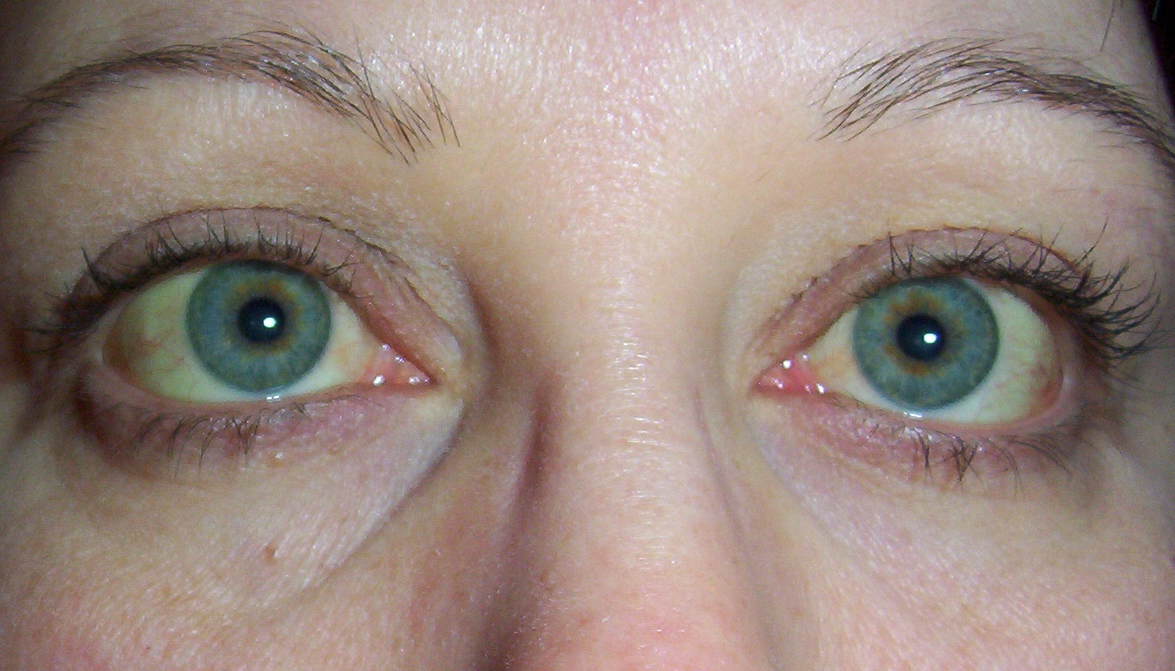 The Chair 200506 The Year That Almost Ended My Life