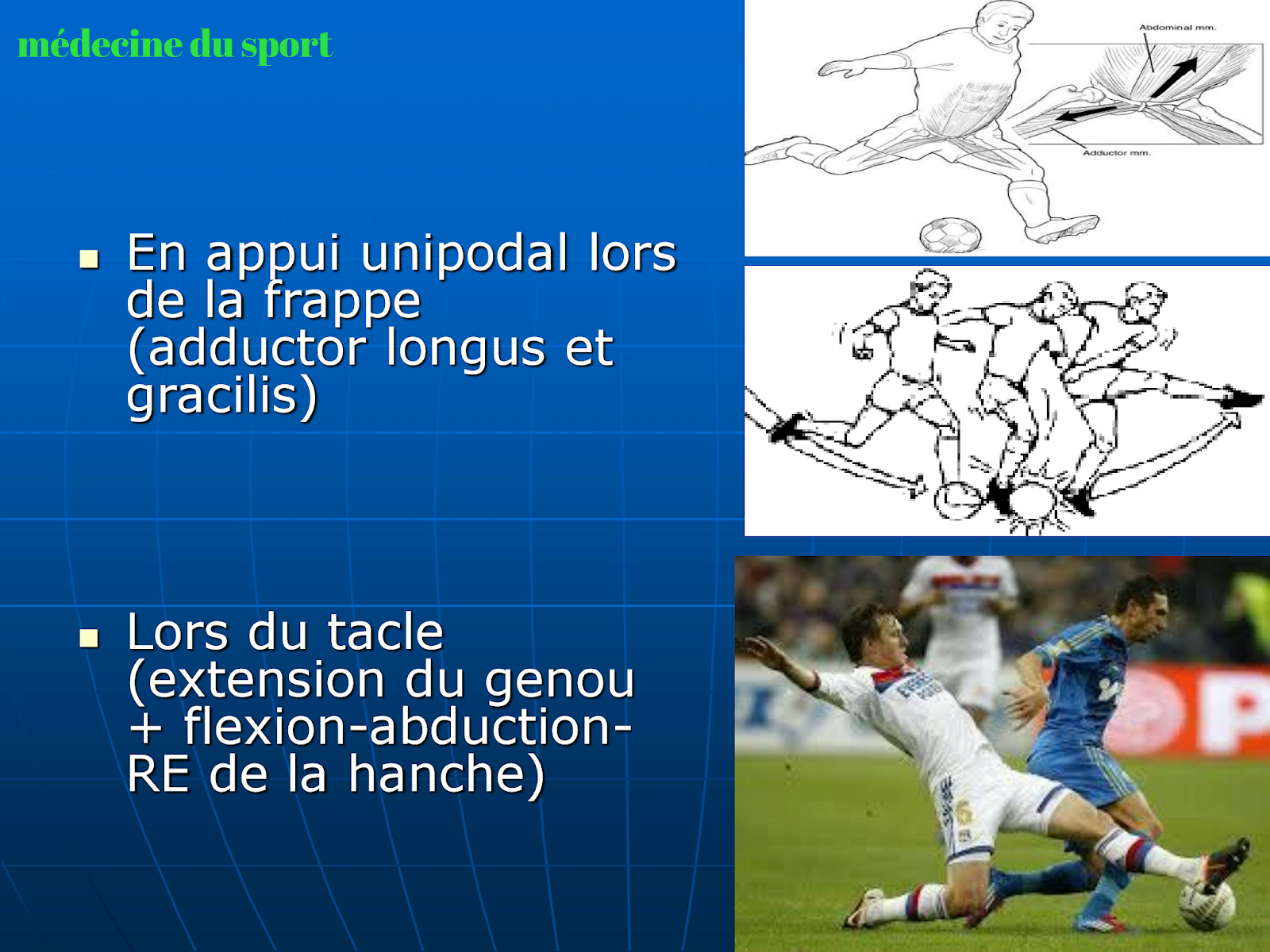 La pubalgie du sportif Traitement et rééducation