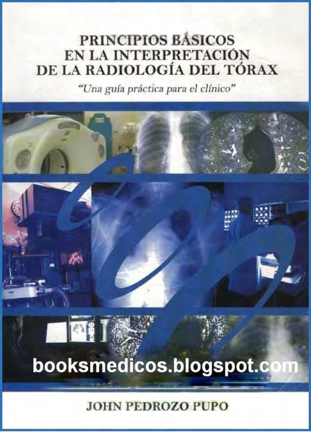 Interpretacion De Radiografia De Torax Epub Download