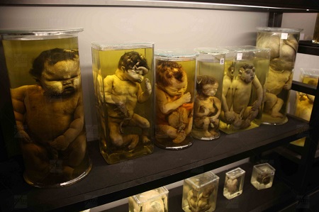 أجنة مشوهة في متحف بالقصر العيني أجنة مشوهة في متحف بالقصر العيني